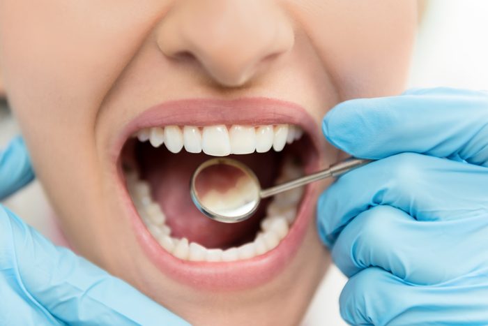 closeup of dental exam