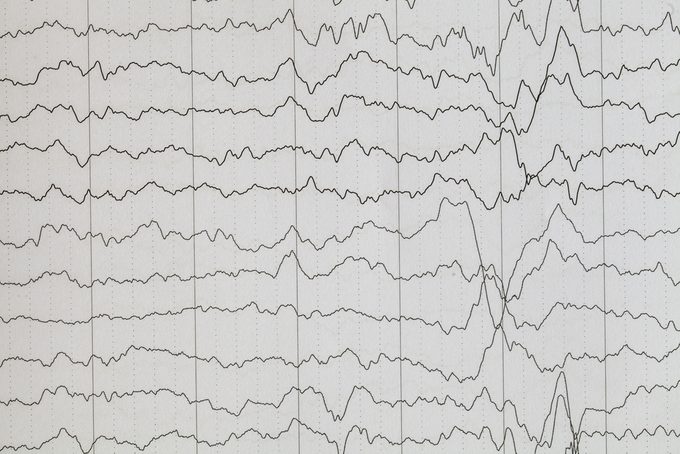 Brain wave on electroencephalogram ,EEG wave background