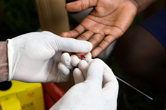 a health worker doing a finger prick test for HIV. He is drawing blood into a capillary tube after pricking the patient with a lancet. Photo taken in Uganda in 2017.