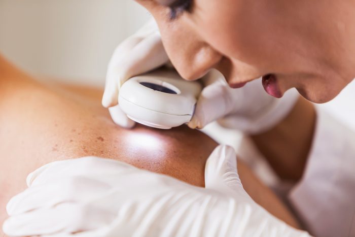 dermatologist examining patient's skin for skin cancer