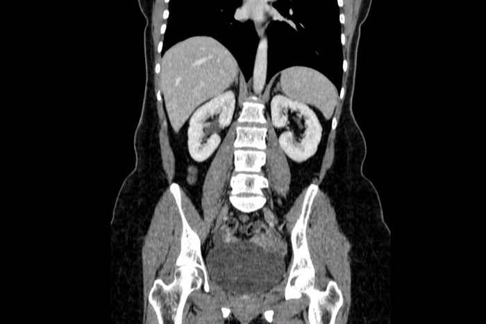 gastrointestinal xray scan