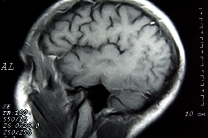 Human Brain scan