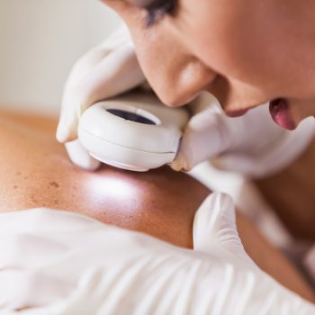 dermatologist examining patient for skin cancer