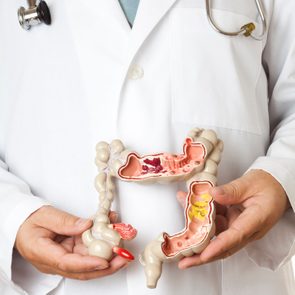 colorectal cancer signs medical model of a colon