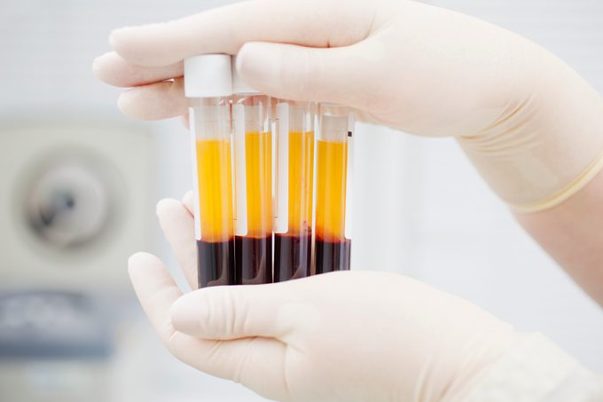 blood with plasma in test tubes for medical research