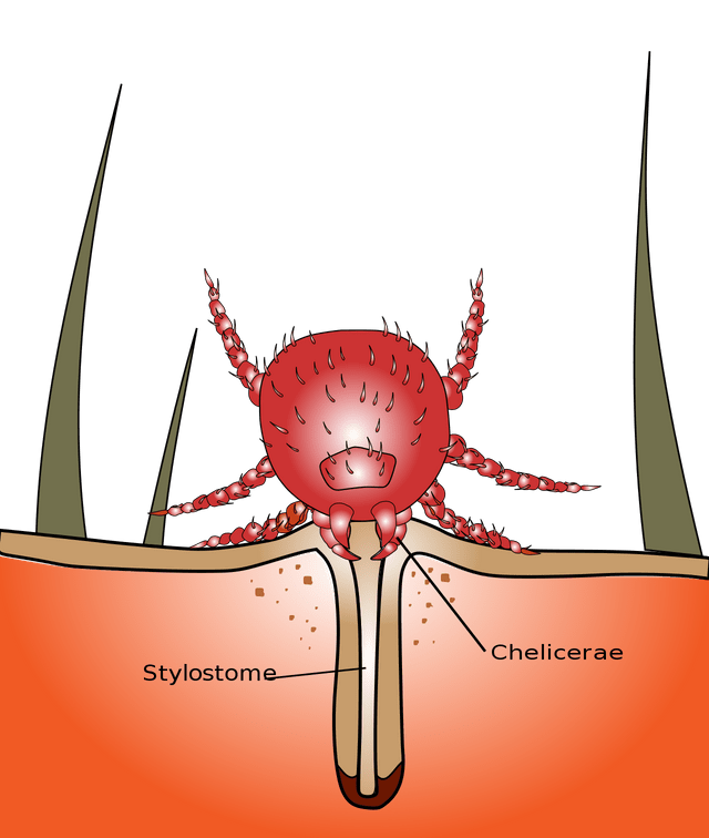 illustration of chigger bite