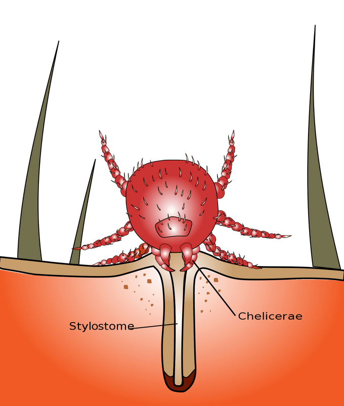 illustration of chigger bite