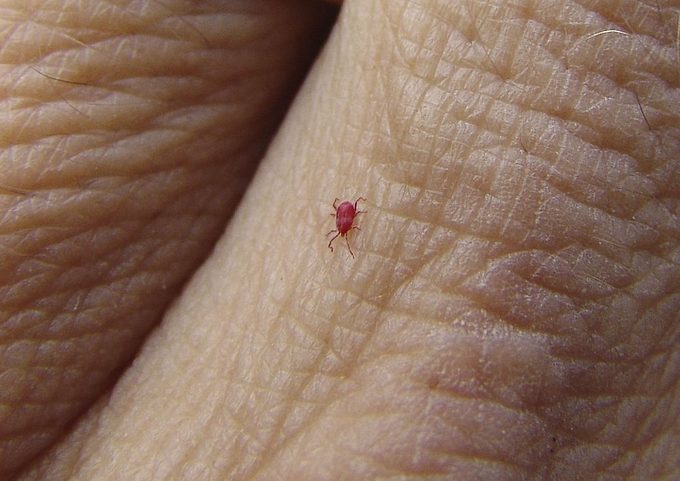 chigger bug on skin