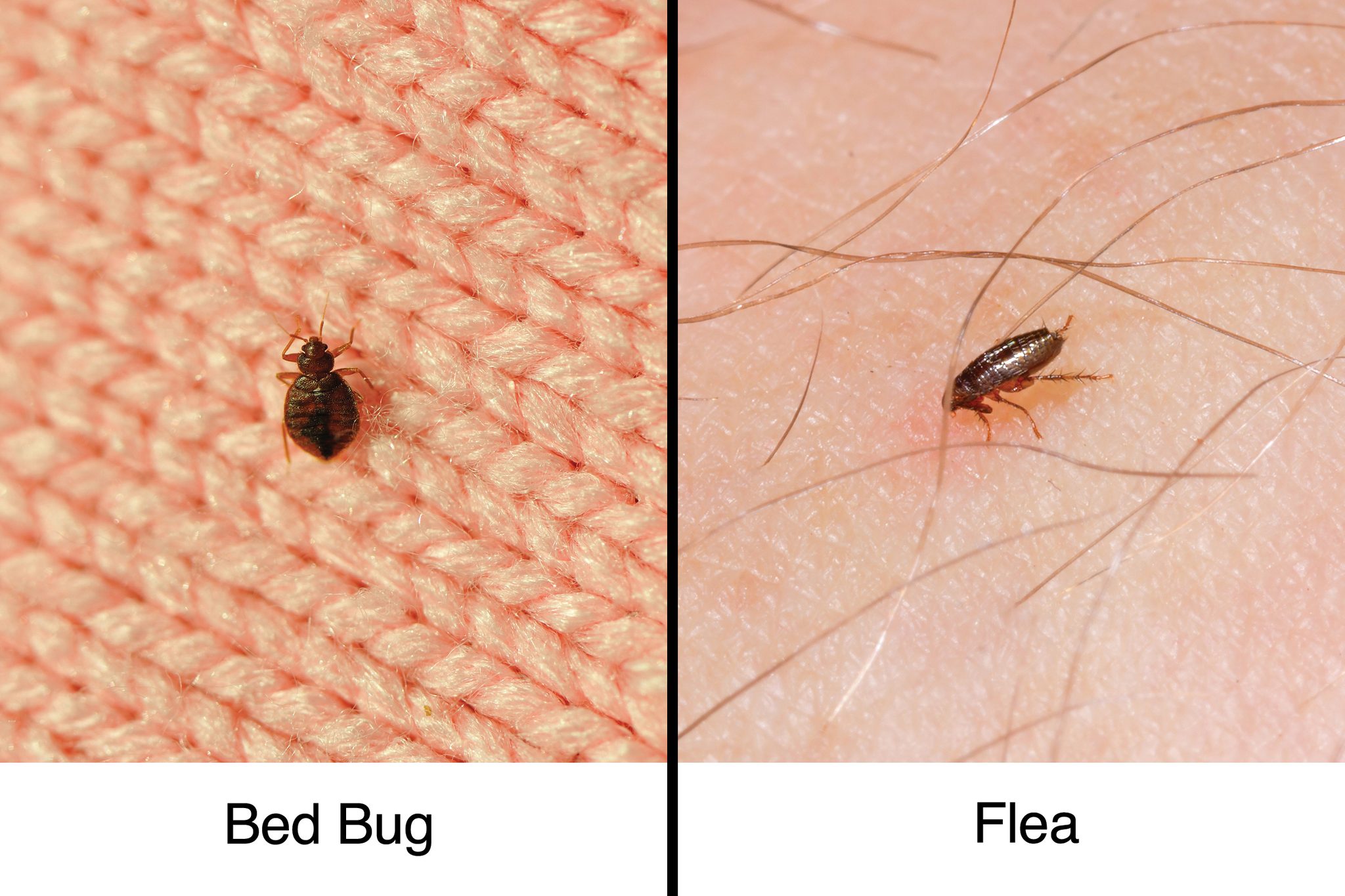 Bed Bug Bites vs. Fleabites: How to Tell the Difference | The Healthy