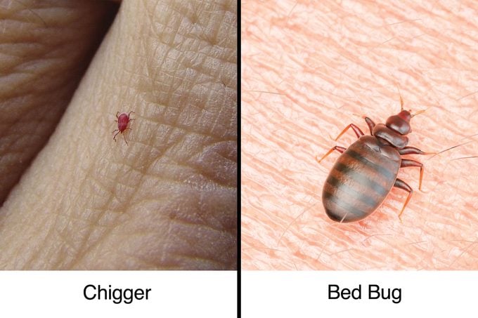chigger bug vs bed bug