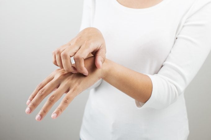 Midsection Of Woman Scratching Hand Against White Background