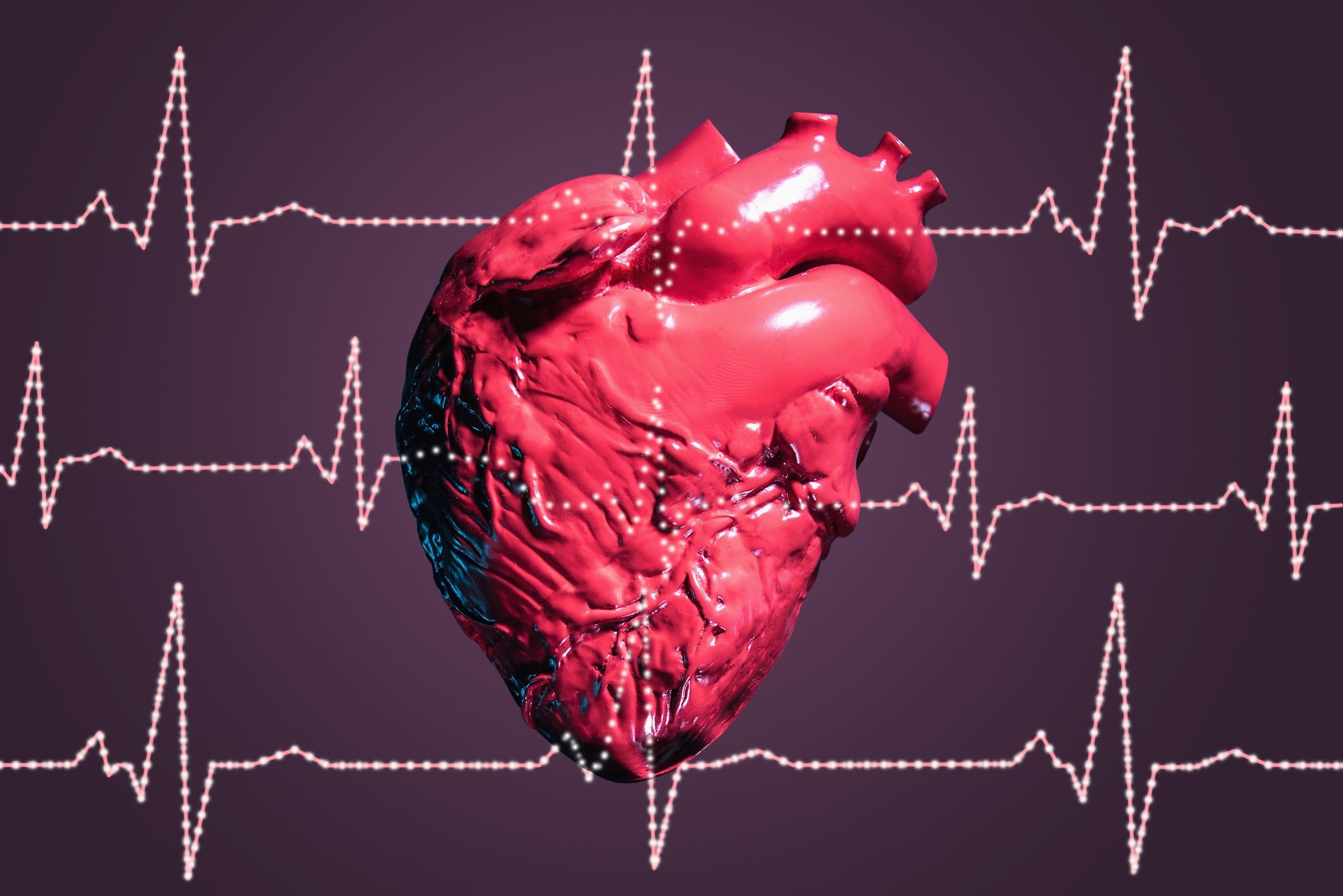 Cardiac Deaths During Workouts 