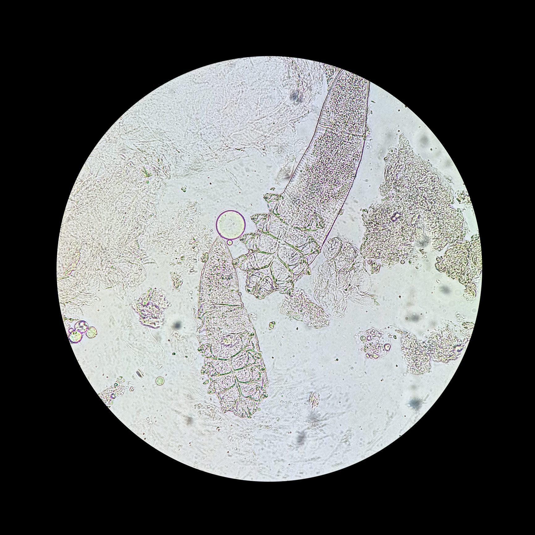 demodex mites under microscope
