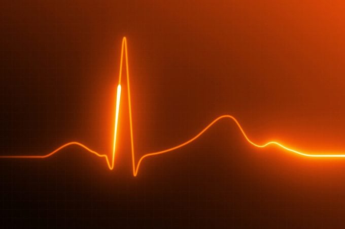 electrocardiogram heart rate image