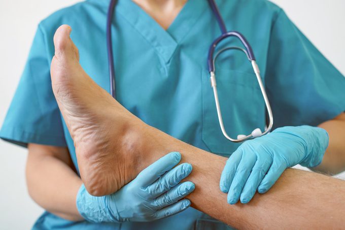 The doctor's hands in gloves hold a foot with toe, infected with nail fungus for examination and diagnosis.