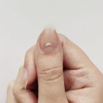 Here’s What It Means if You Have White Spots on Your Nails