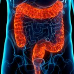What You Need to Know About Ulcerative Colitis
