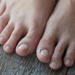 6 Causes of Yellow Toenails and Treatments That Help