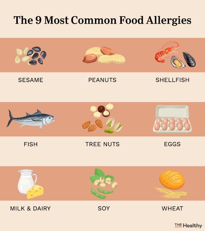 Most Common Food Allergies Infograph8ic01