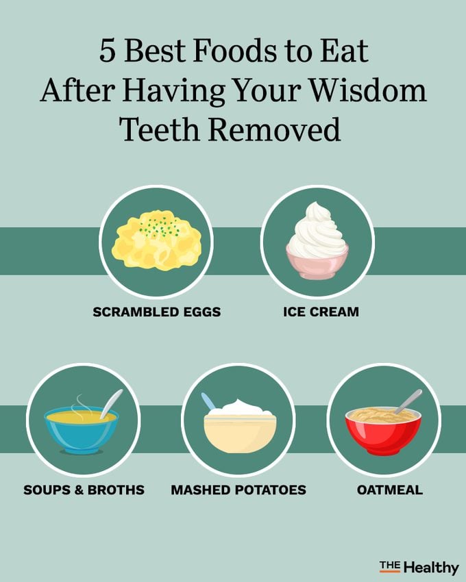 Wisdom Teeth Foods Infographic02