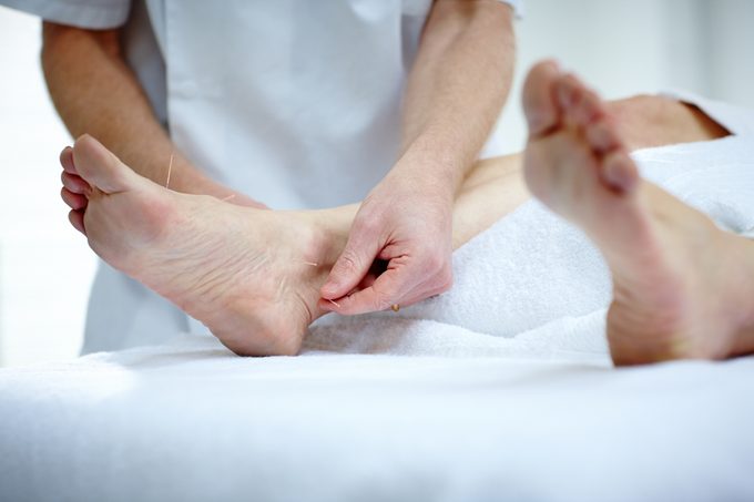 Woman's feet receiving acupuncture treatment
