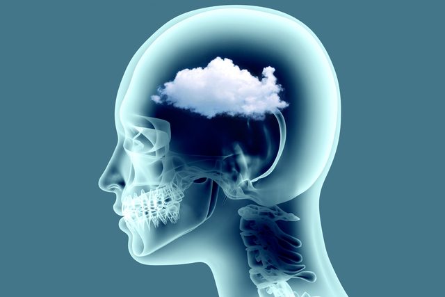 x ray image of human brain with cloud detail