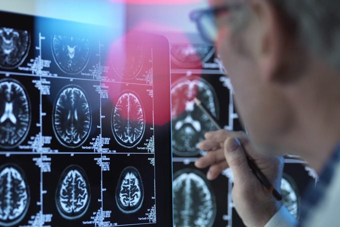 Doctor viewing brain scans for possible disease or damage in clinic