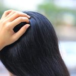 Is It Scalp Psoriasis or Dandruff? Here’s How to Tell the Difference