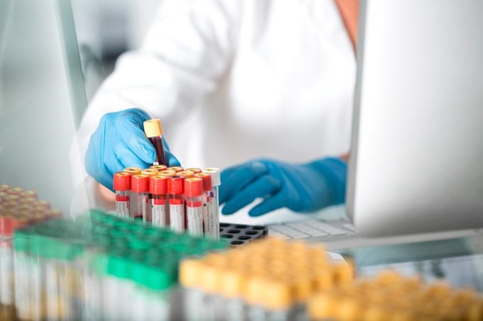 Close-up of lab technician examining blood samples in laboratory