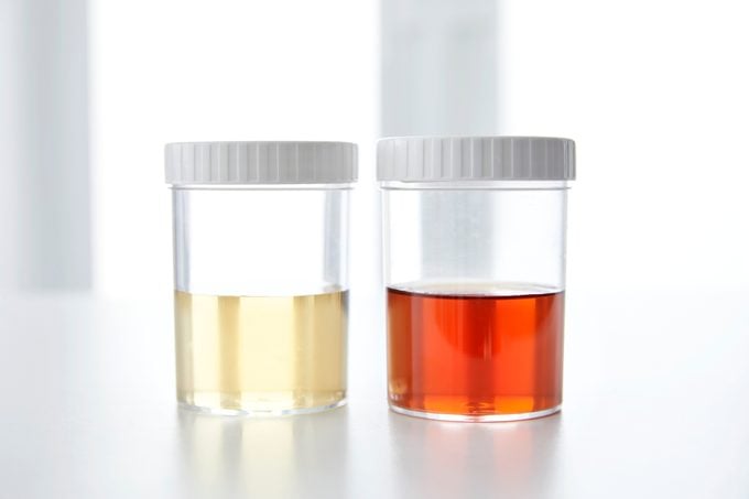 two urine sample cups side by side