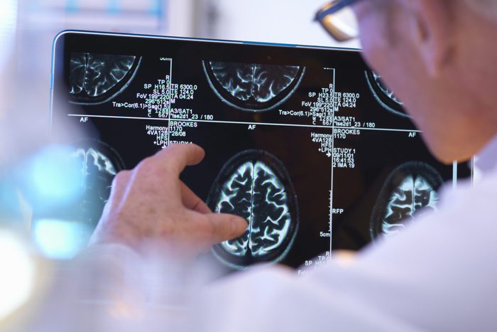 Radiologist assessing CT brain scan
