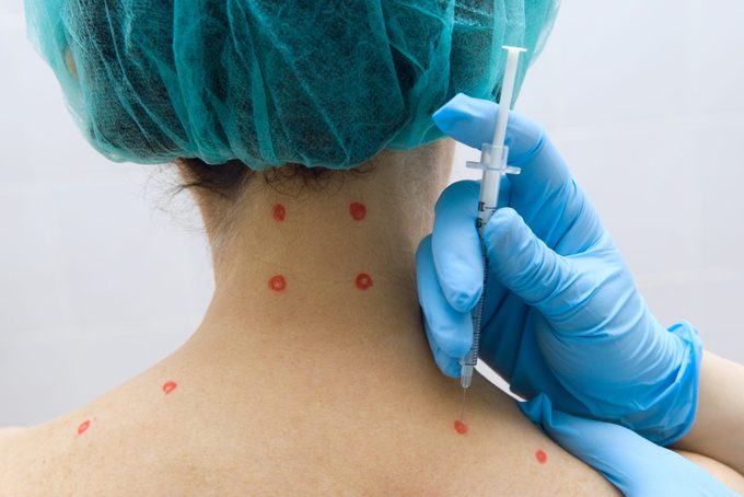 doctor performing trigger point injection therapy on patient's back and neck