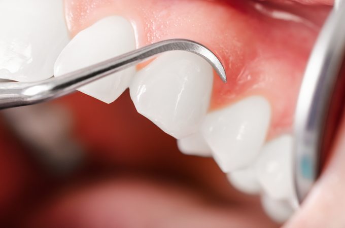 Examen dental completo