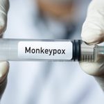Monkeypox Symptoms and 7 Other Facts from Epidemiologists