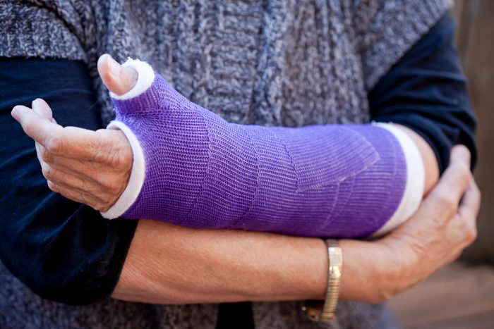 Midsection of woman wearing a purple cast on a broken arm