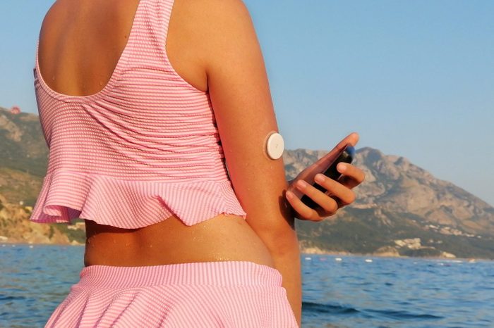 Girl Checks Glucose Level With Cgm Device Before Enters The Sea.