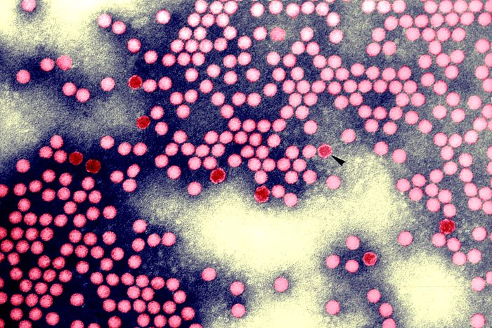 Electron Micrograph Of Poliovirus Type 1
