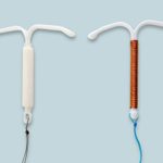 Hormonal vs. Nonhormonal IUD for Birth Control: Which Should You Get?