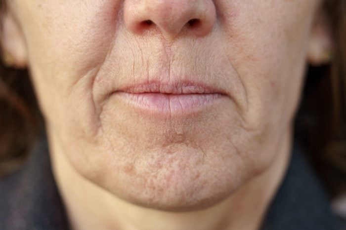 Close up detail of the chin of a middle-aged woman