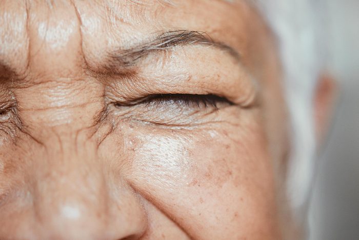 wrinkles on face