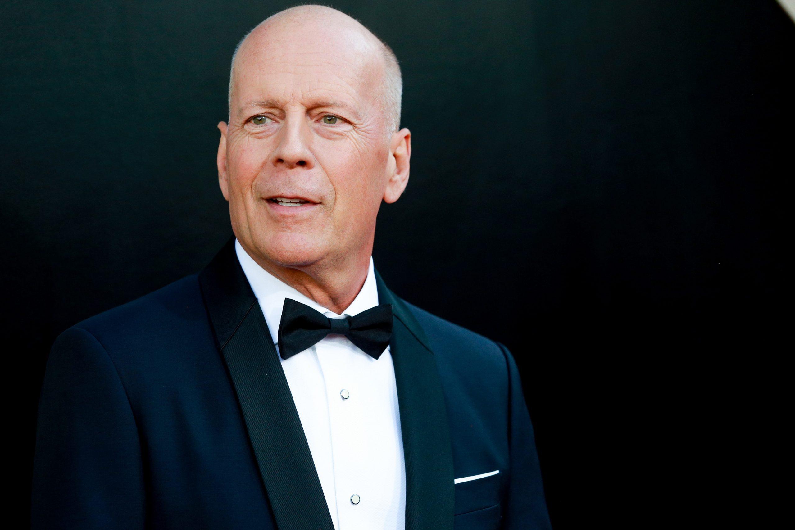What Is Frontotemporal Dementia? Bruce Willis' Condition, Explained ...