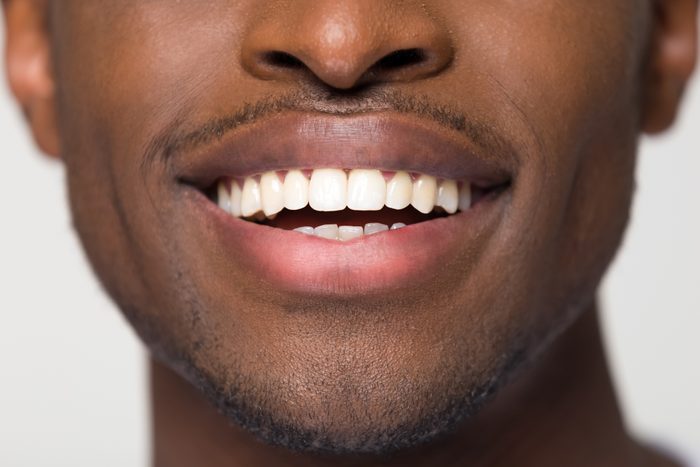 Close up view of beaming orthodontic white wide male smile