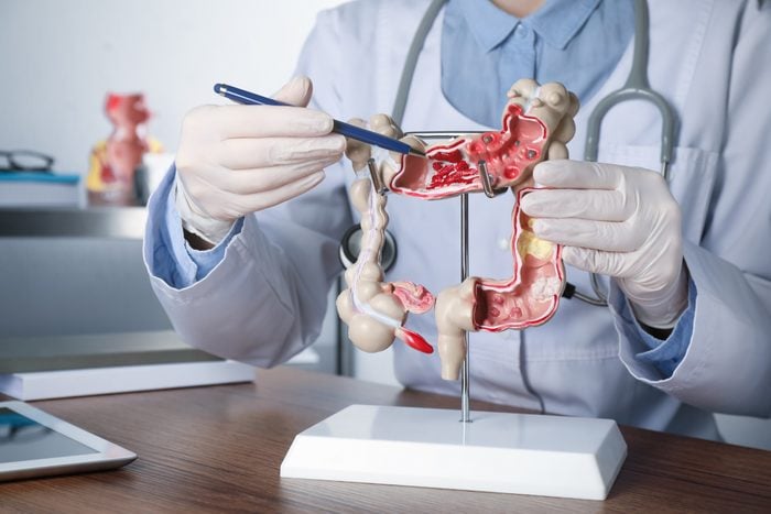 Gastroenterologist showing human colon model at table in clinic, closeup