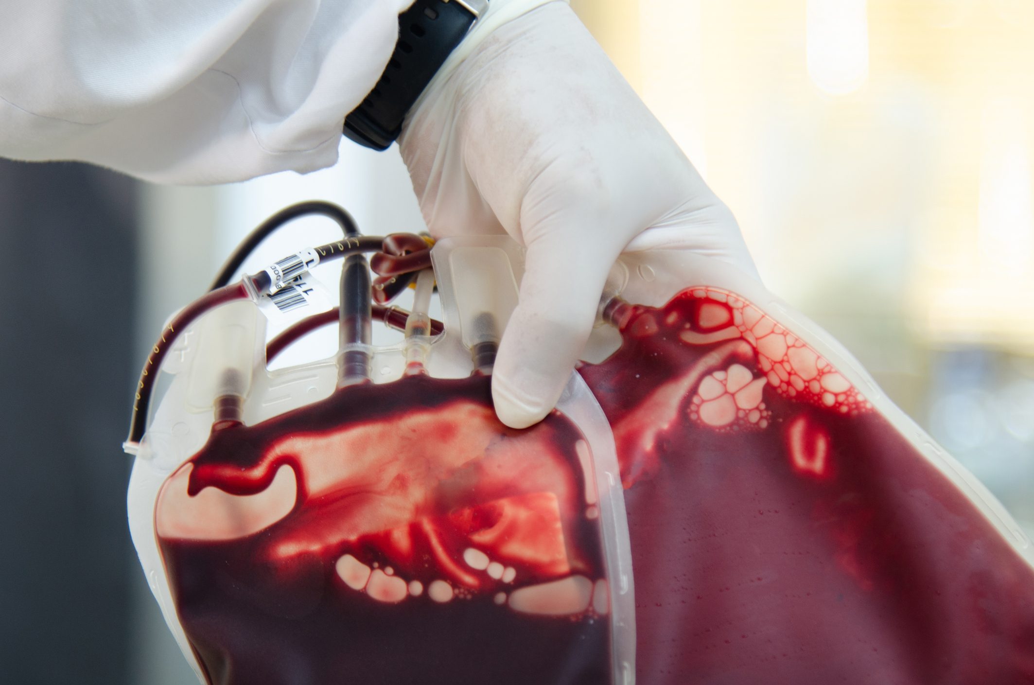 Blood bag with scientis in laboratory.