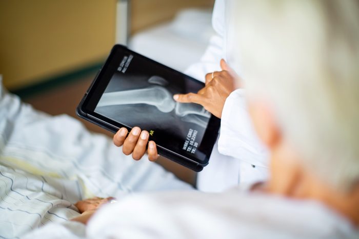 orthopedic doctor holding a tablet with an X-ray on it