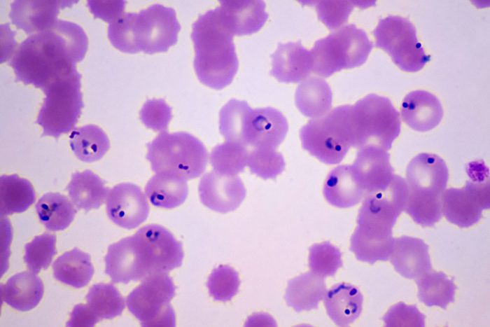Plasmodium falciparum in ring stage in human red blood cells. Malarial Parasite