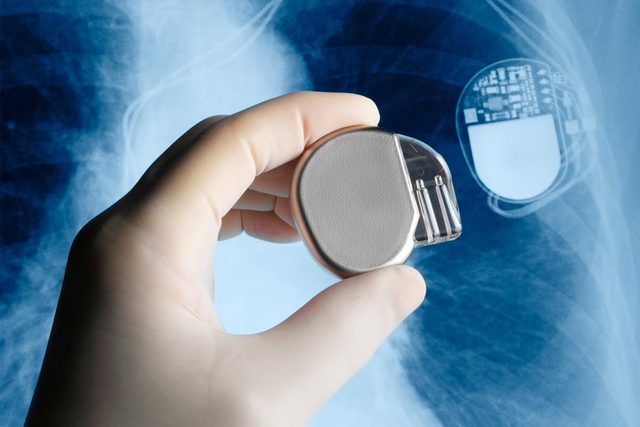 Surgeon holding pacemaker next to x-ray