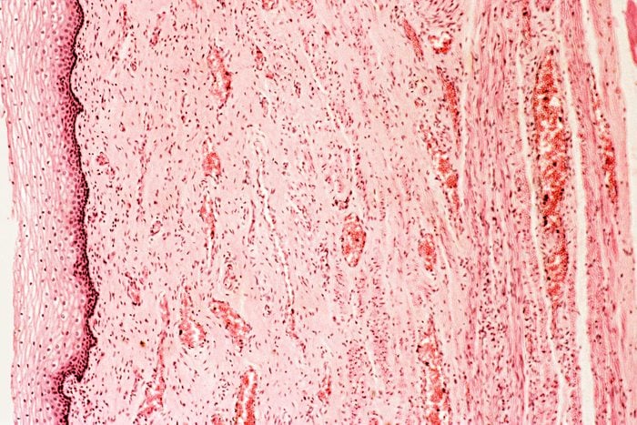 close up magnification of Vagina tissue