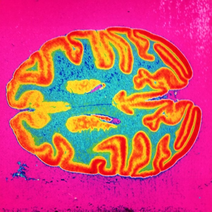 brightly colored brain scan to show brain in love
